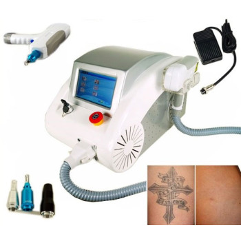 Tetoválás eltávolító gép